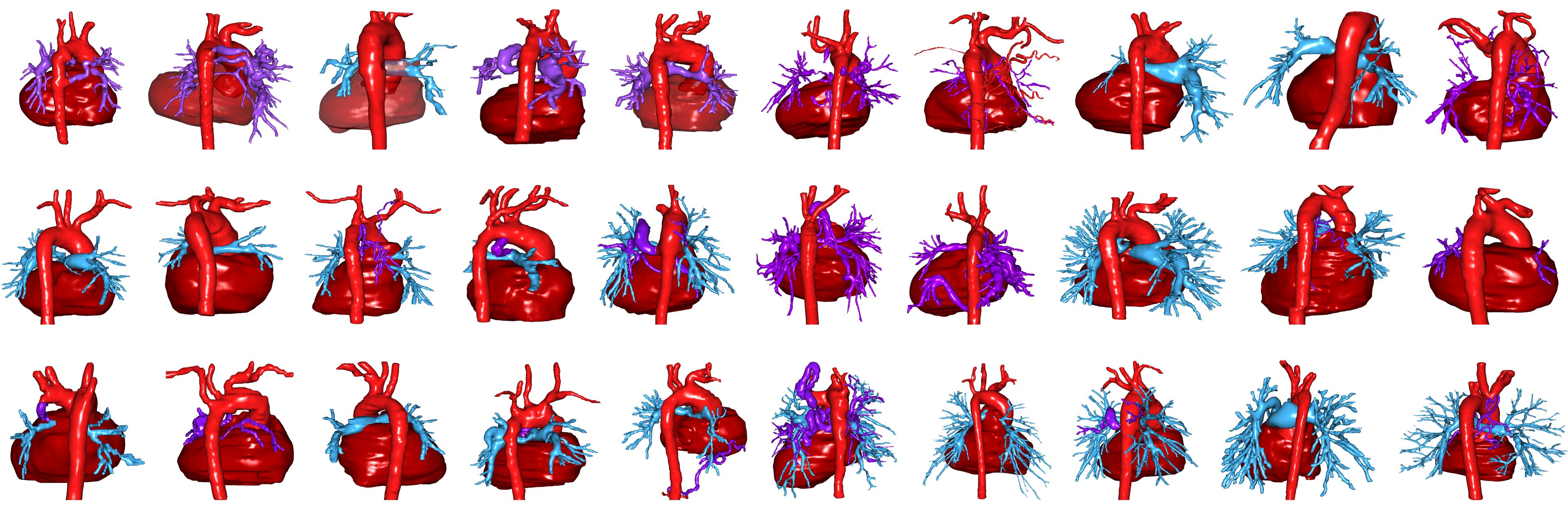 CIRCULATION UpーtoーDate 8ー3-現在と未来をになうCardiologistのための 進化した3Dイメージング 前編 CT・MRIの [大型本] CIRCULATION UpーtoーDate 8ー3-現在と未来をになうCardiologistのため